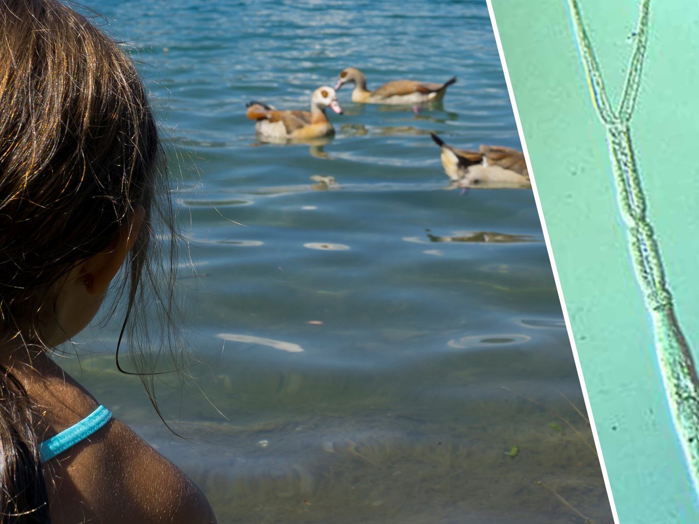 Sobald die Wassertemperatur in Badeseen über 24 Grad steigt, vermehren sich Zerkarien rasant.