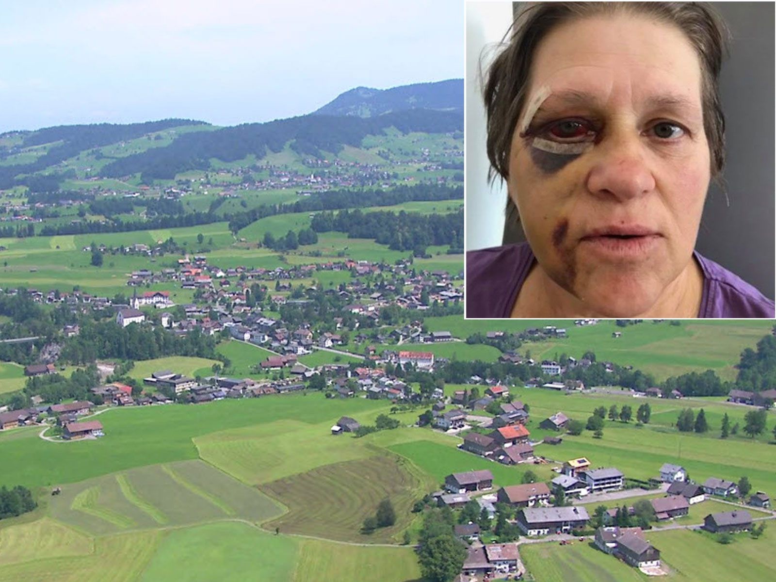 Frau erlitt schwere Verletzungen