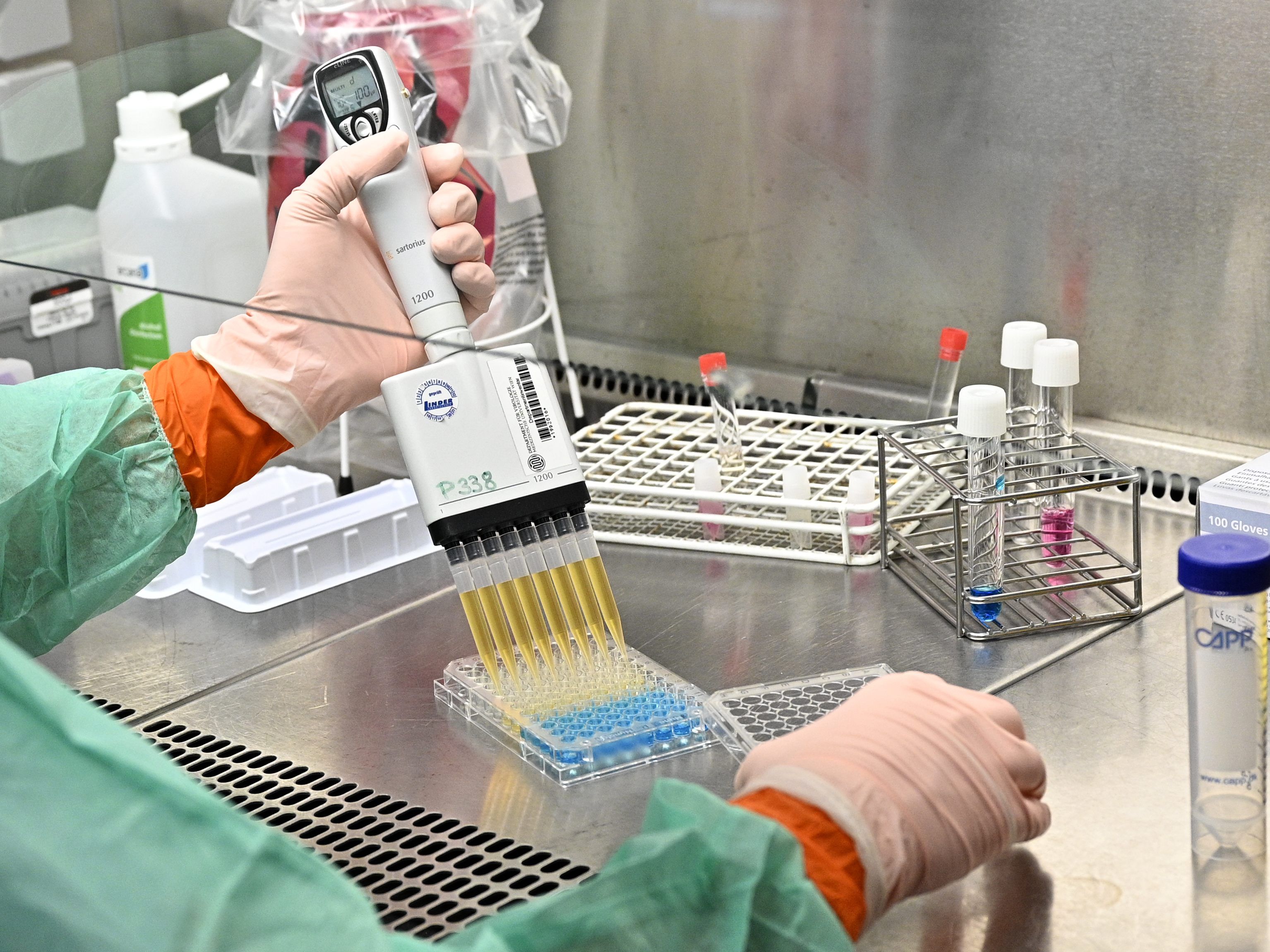 Bisher wurden in Österreich 206 Patienten positiv auf das Coronavirus getestet.
