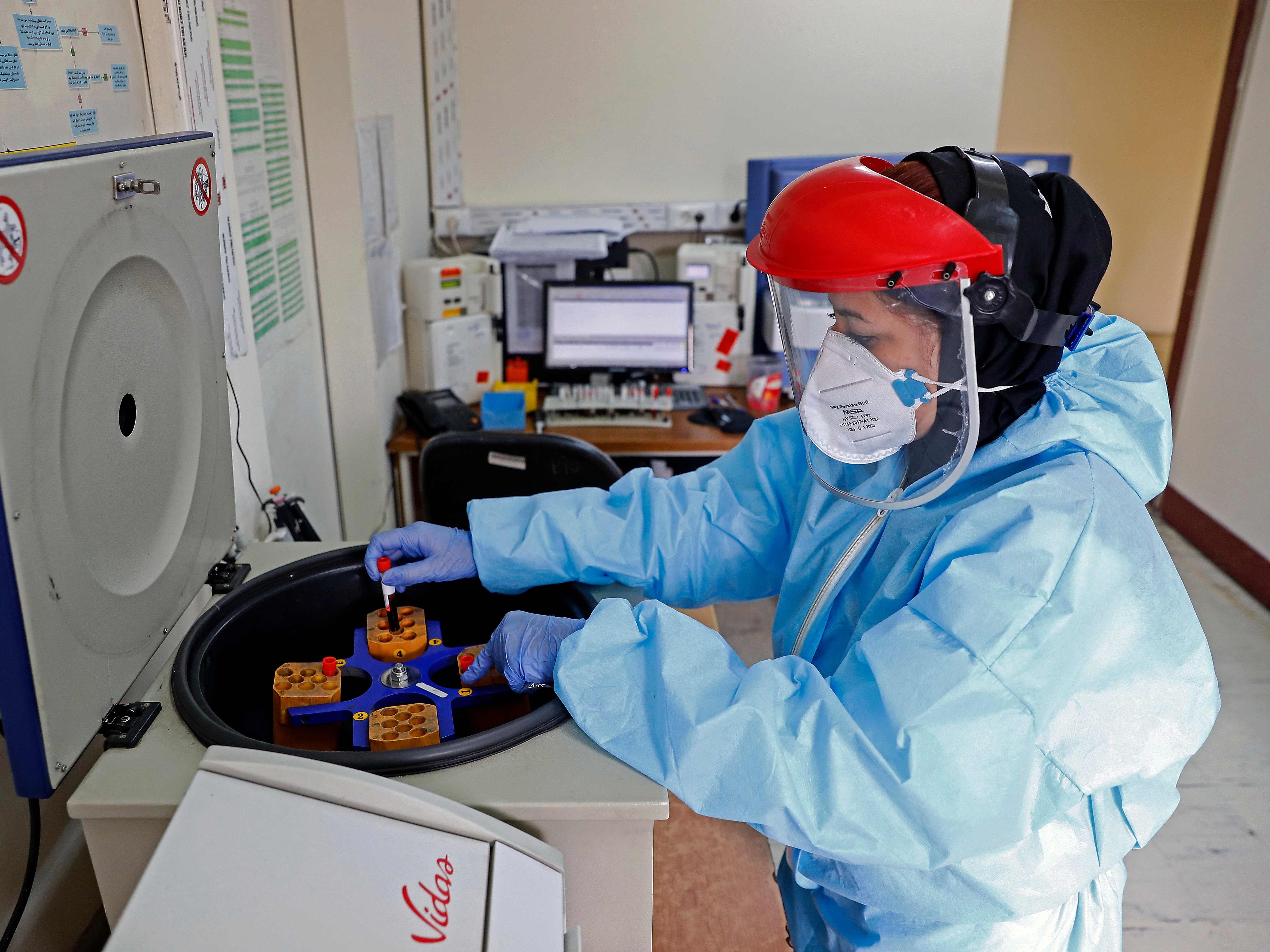 Nun gibt es drei Coronavirus-Fälle in der Steiermark.
