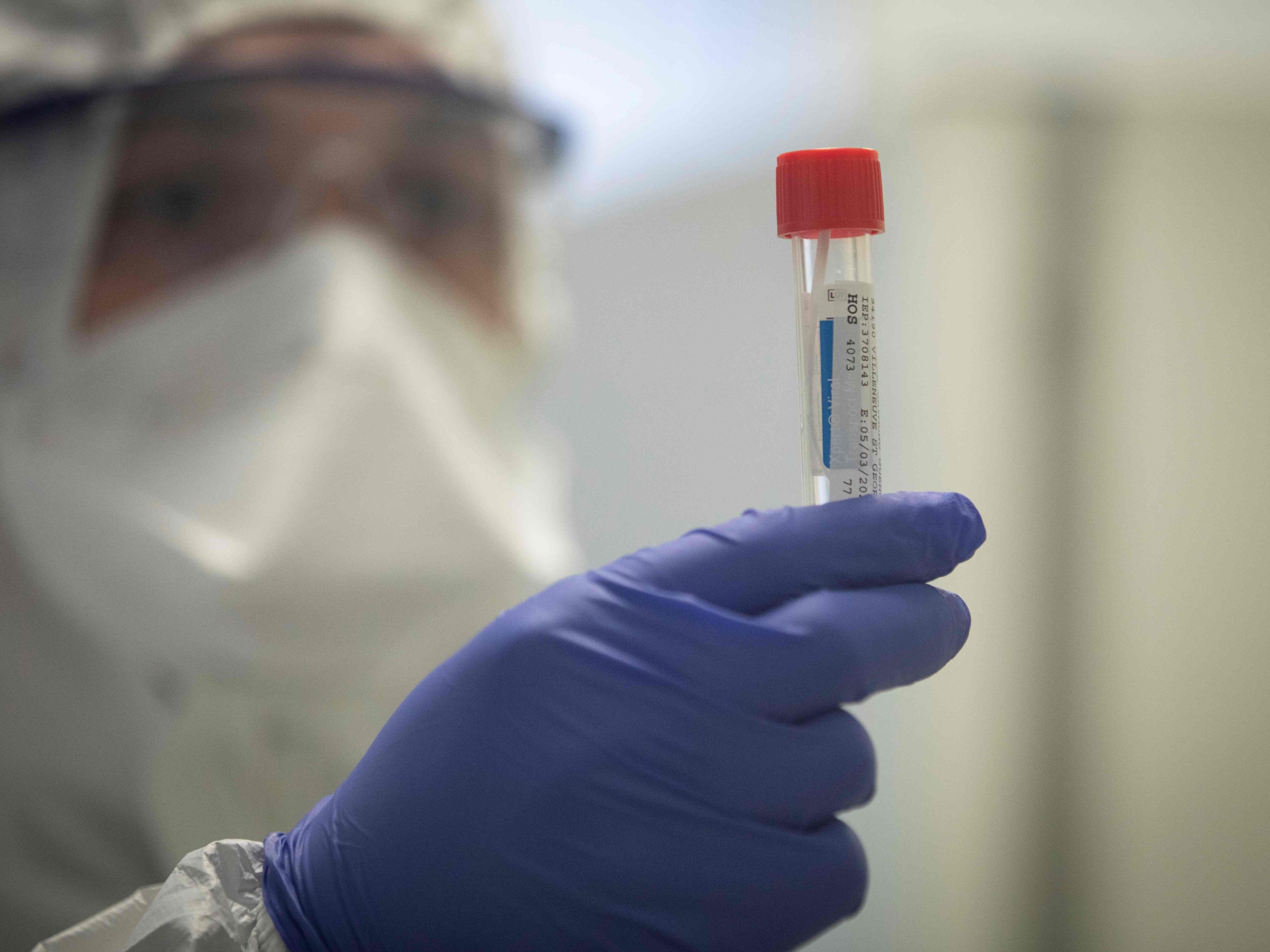 Am Freitag gab es in Österreich 55 bestätigte Coronavirus-Fälle.