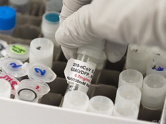 Entwicklung von Coronavirus-Impfstoffen