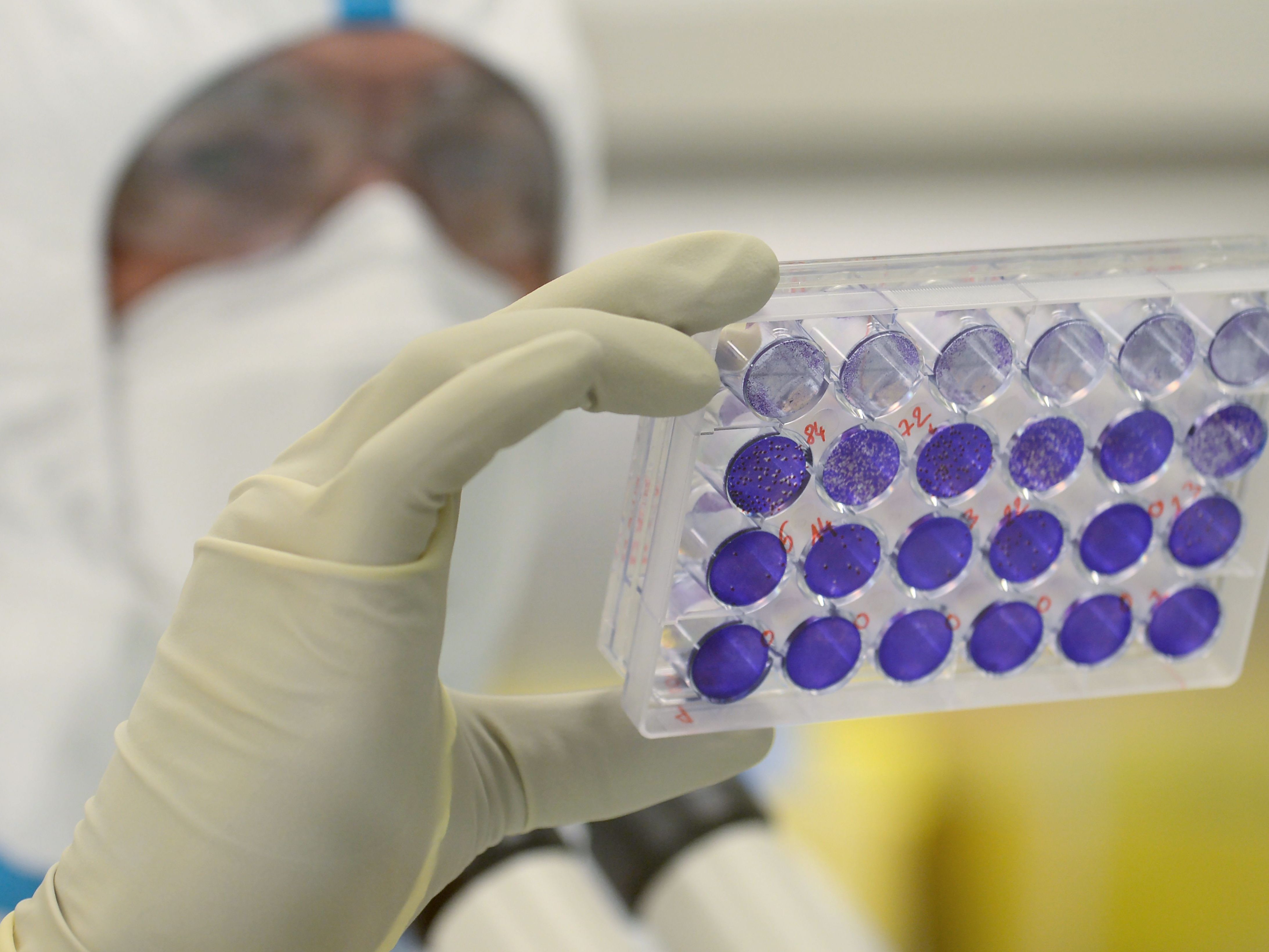 Französisch-österreichisches Biotechunternehmen testet "VLA2001" in Großbritannien.