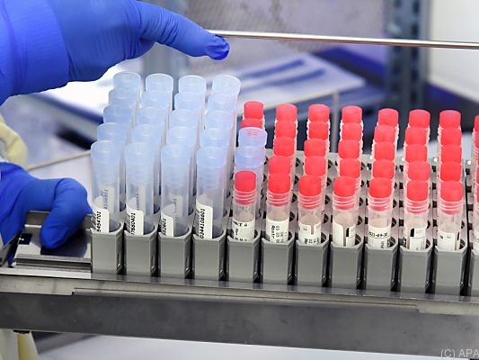 Auch Anteil positiver PCR-Tests angestiegen