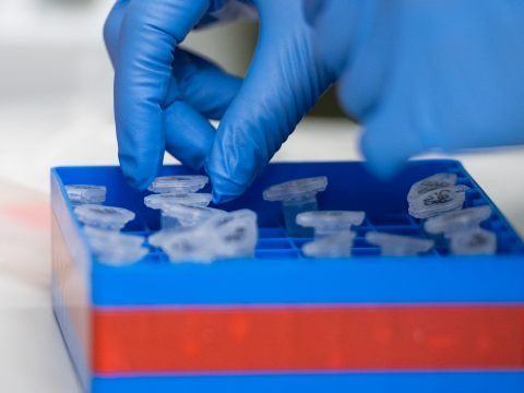 Apeiron: Wiener Unternehmen meldet signifikante Reduktion der Tage mit mechanischer Beatmung.