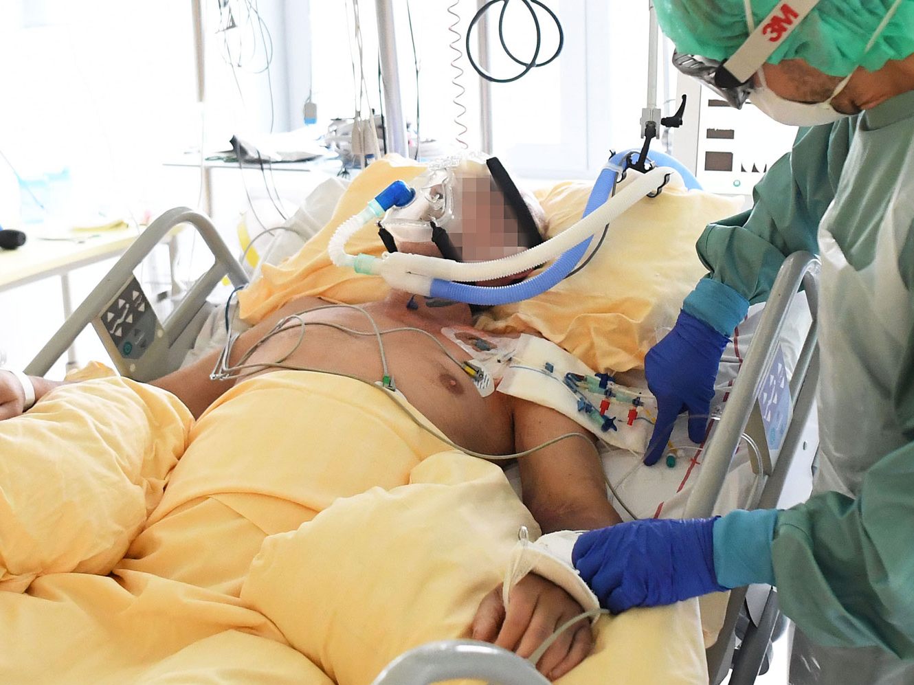 Immer mehr Corona-Patienten müssen auf Intensivstationen behandelt werden. (Symbolbild)
