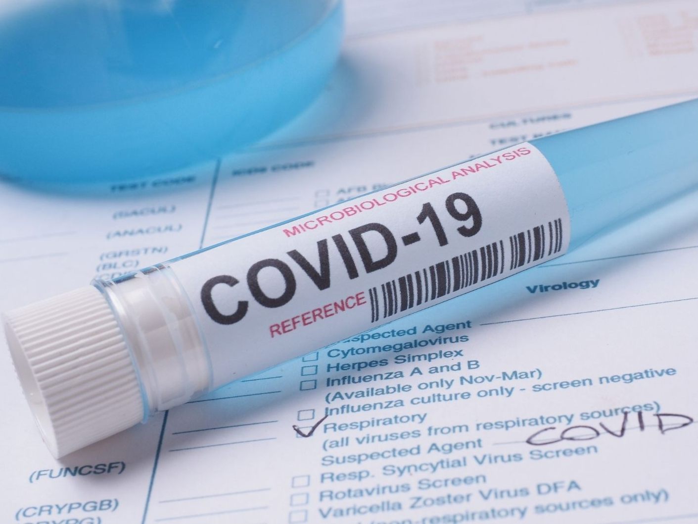 Es befinden sich 24 Covid-Patienten in Vorarlbergs Spitälern.