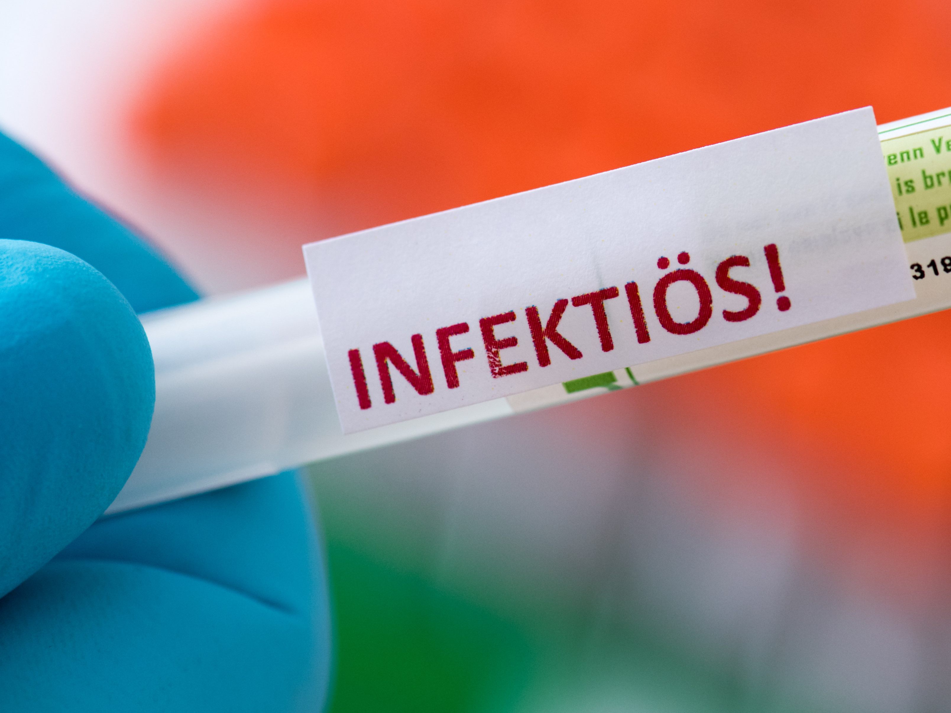 Sprunghafter Anstieg bei Neuinfektionen