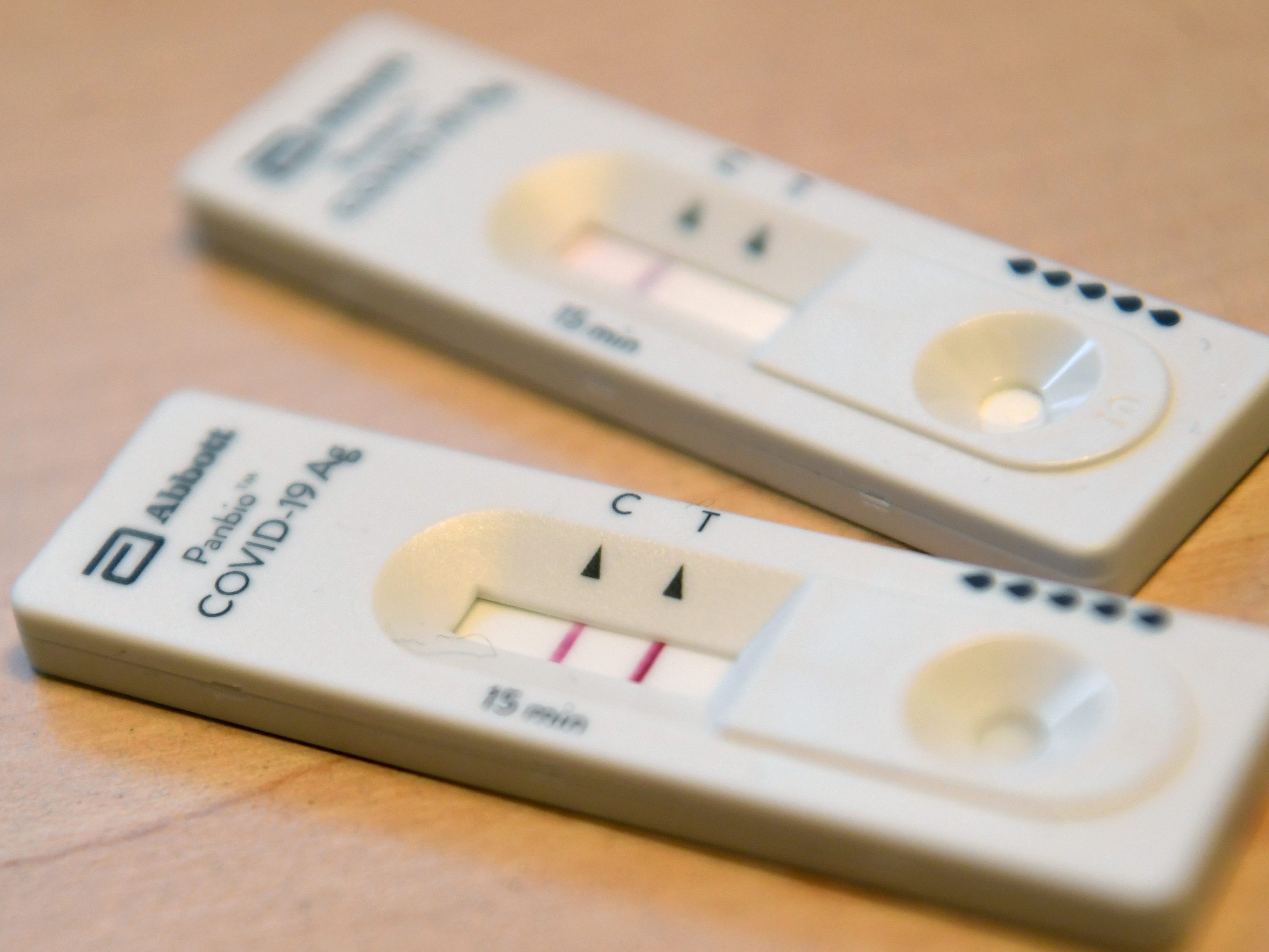 Kostenlose Corona-Tests bleiben für symptomatische Personen weiter möglich.
