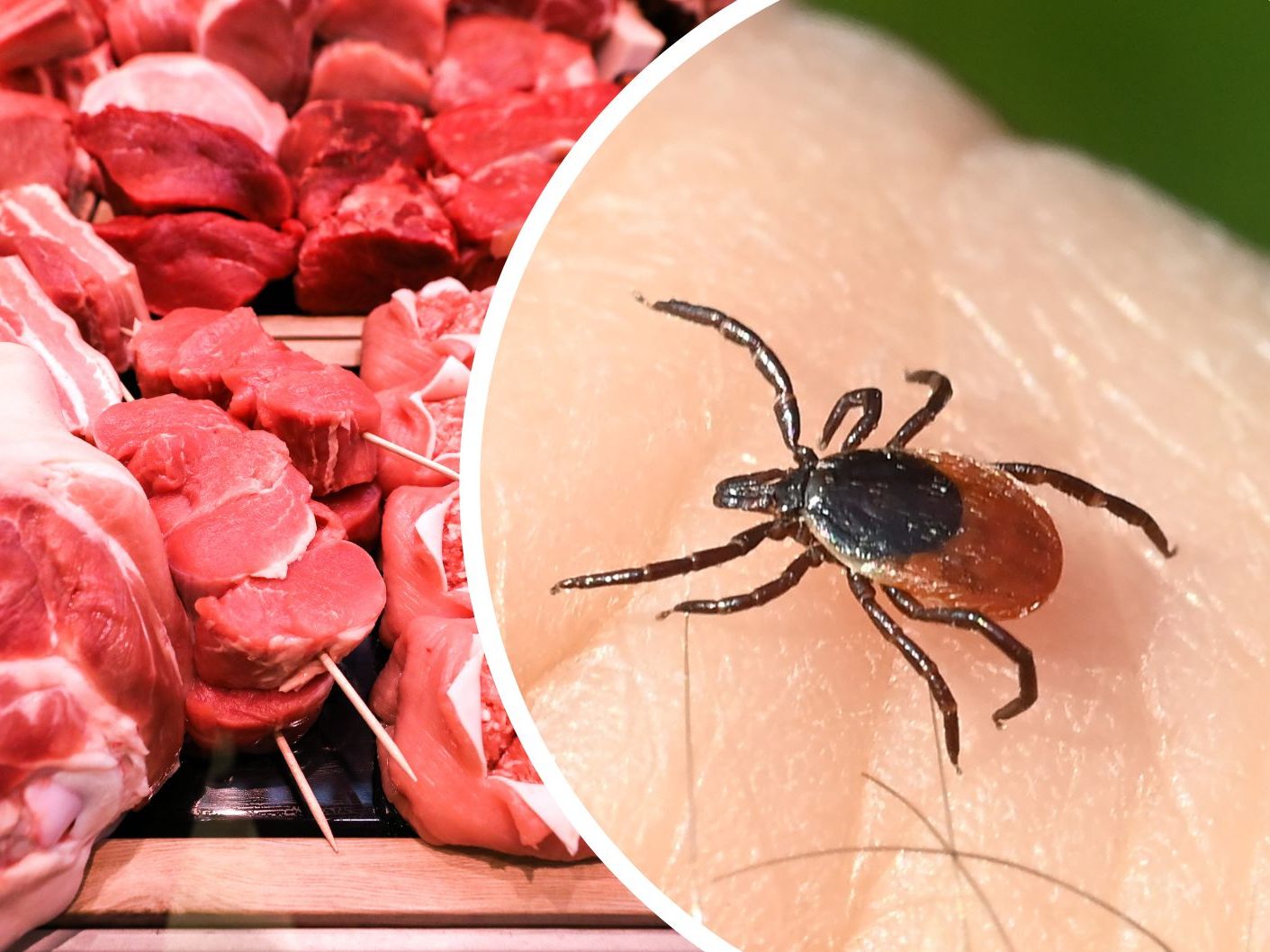 Fälle von Fleischallergie nach Zeckenstichen sind auch in Österreich bekannt.