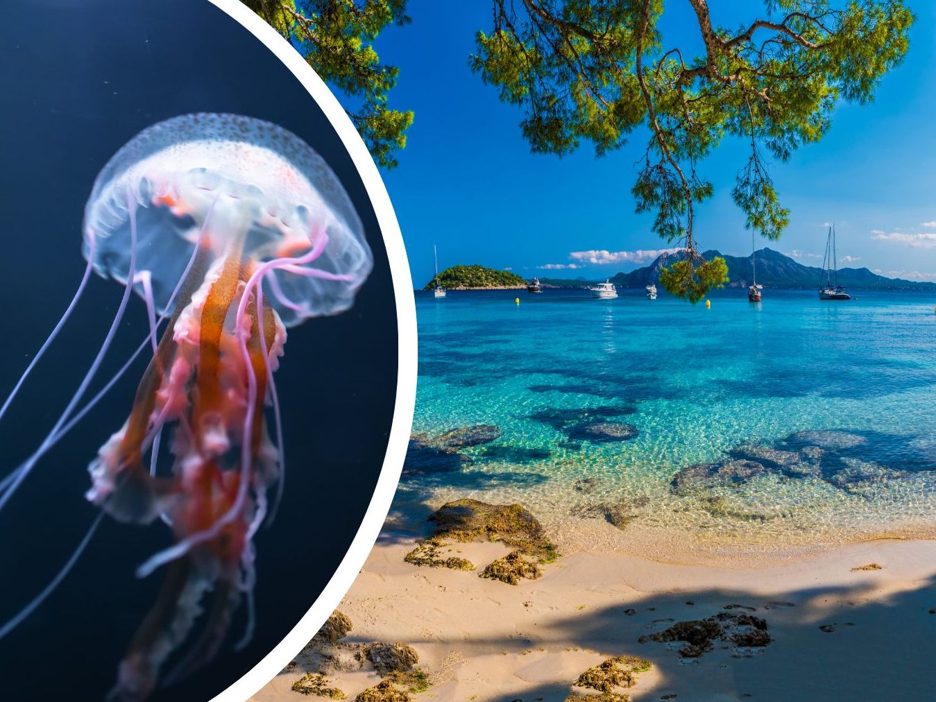 Für ein paar Urlauber hatte das Zusammentreffen mit den Quallen schmerzhafte Folgen.