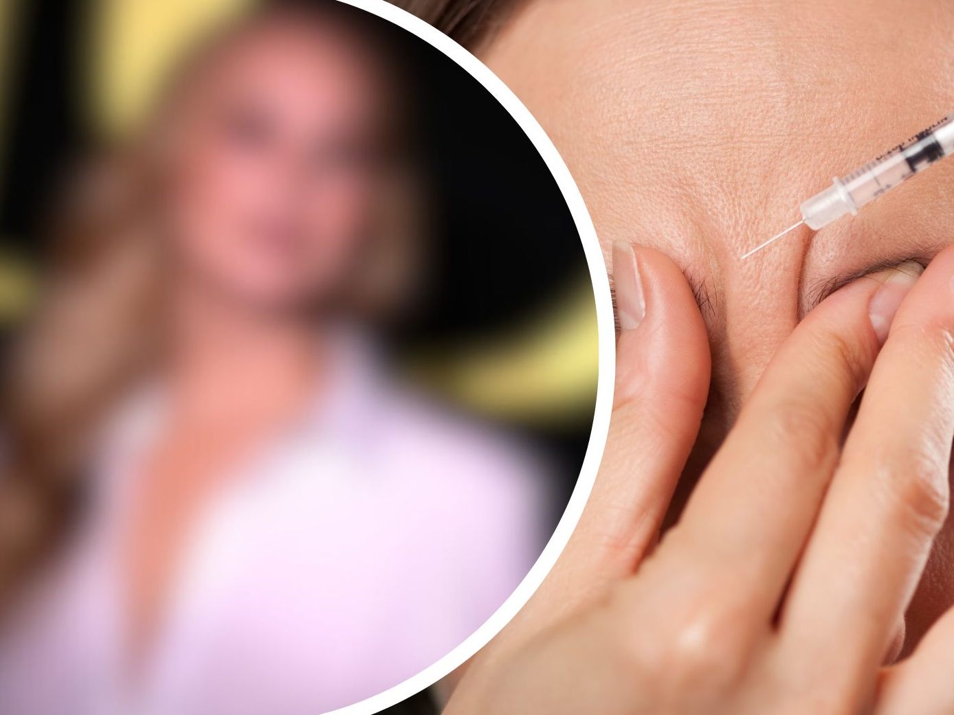 War das zu viel des Guten? Im Internet spekulieren Fans über einen möglichen Beauty-Eingriff.