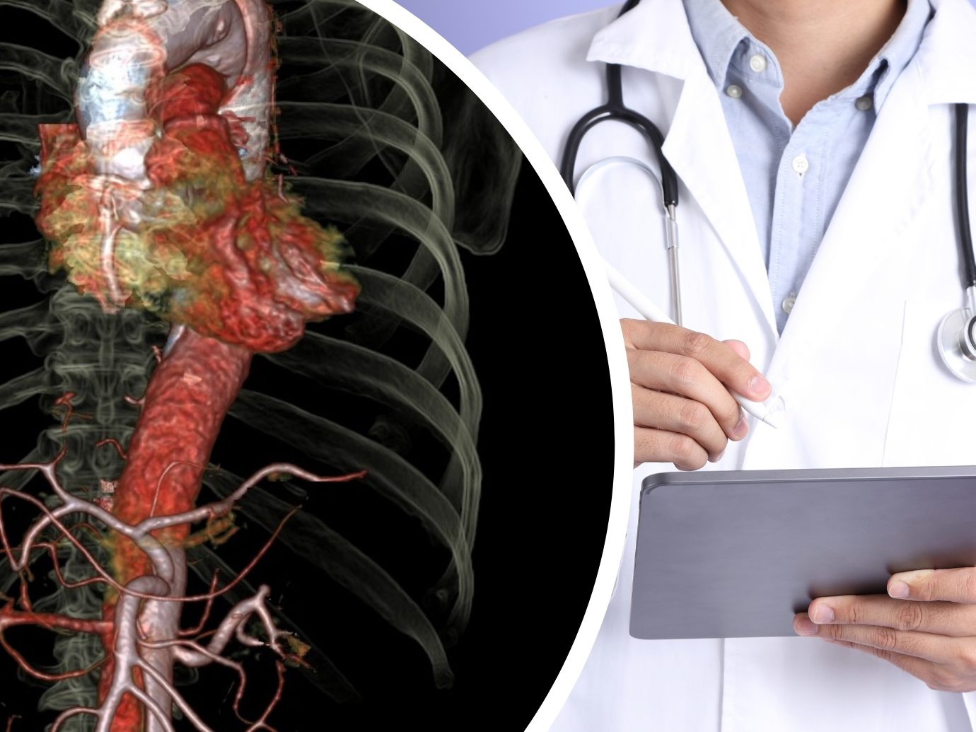 Aorta als Organ anerkannt