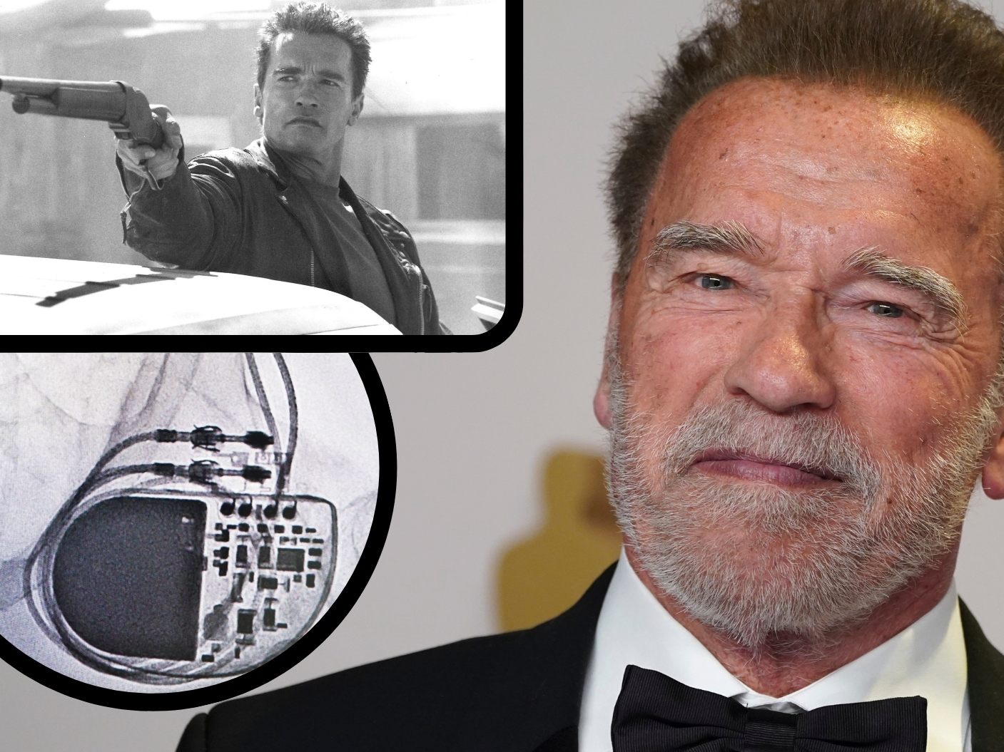 Der "Terminator" bekam Herzschrittmacher
