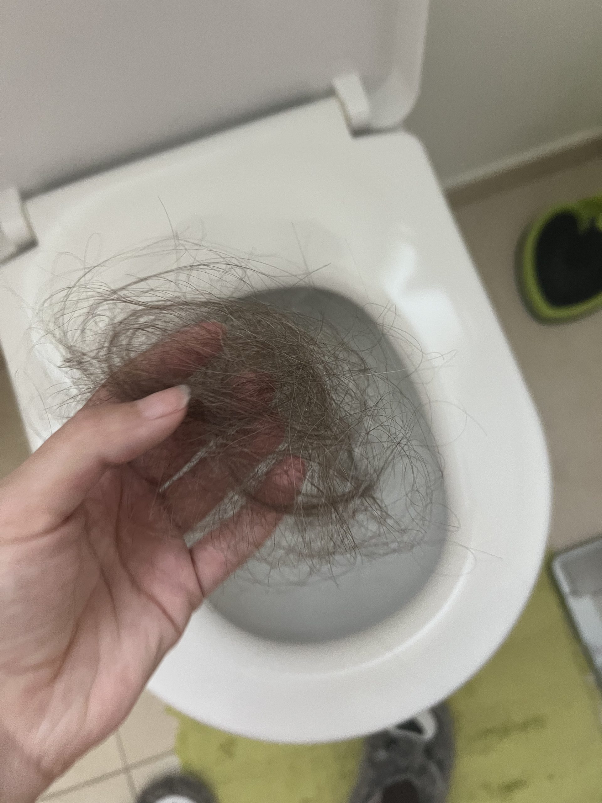 Ihre Haare fielen ihr etwa zwei Wochen nach der ersten Chemo aus. 