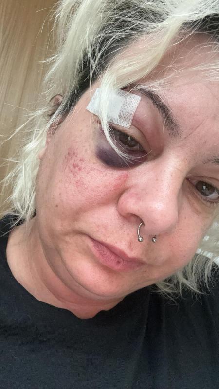 Jennifer hatte laut eigenen Angaben einen Arbeitsunfall auf dem Firmengelände.