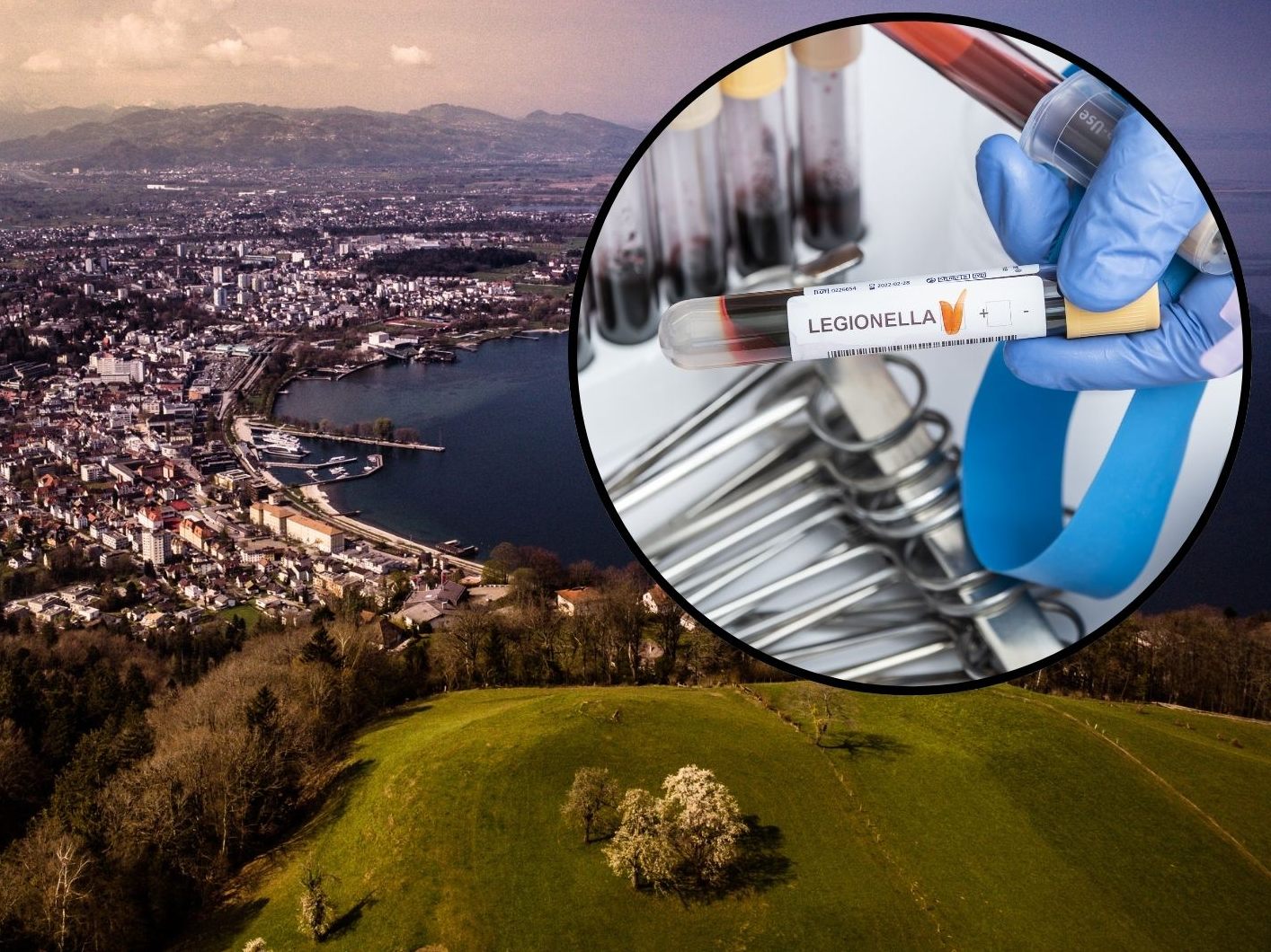 29 von 32 Fällen wurden im Unterland registriert.
