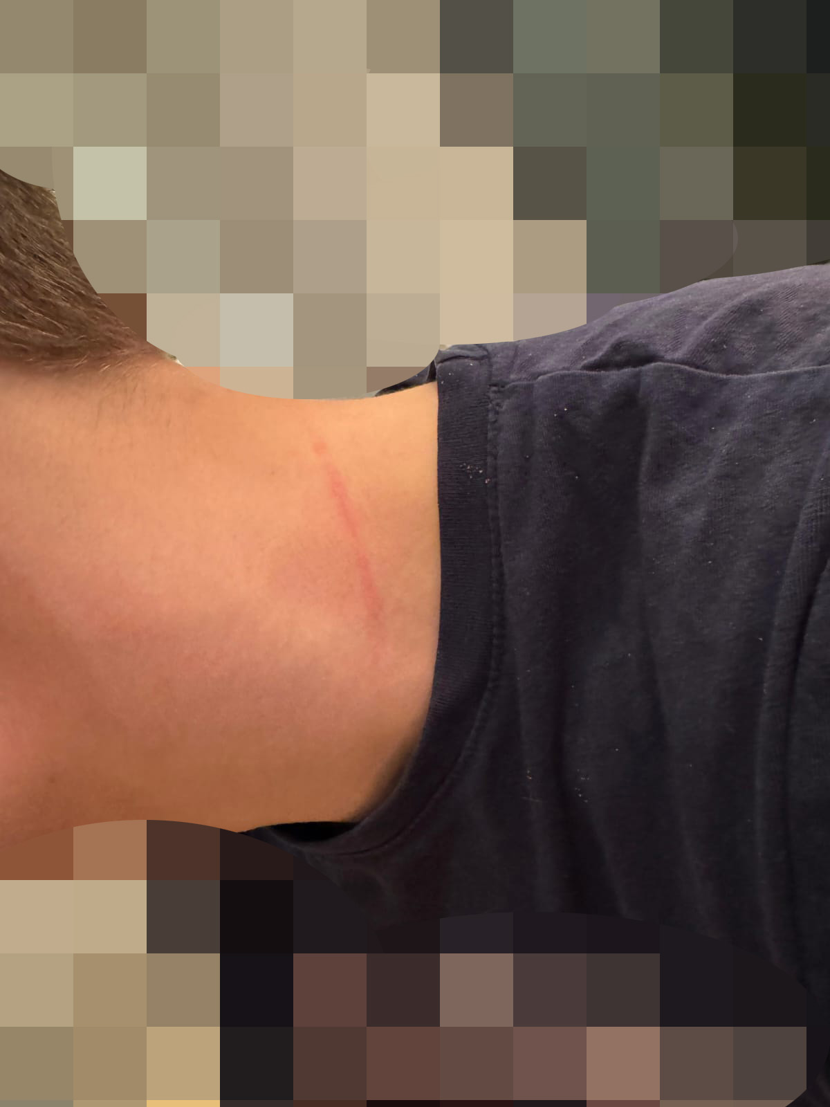 Das Foto zeigt einen langen Kratzer, der sich an seinem Hals entlangzieht.