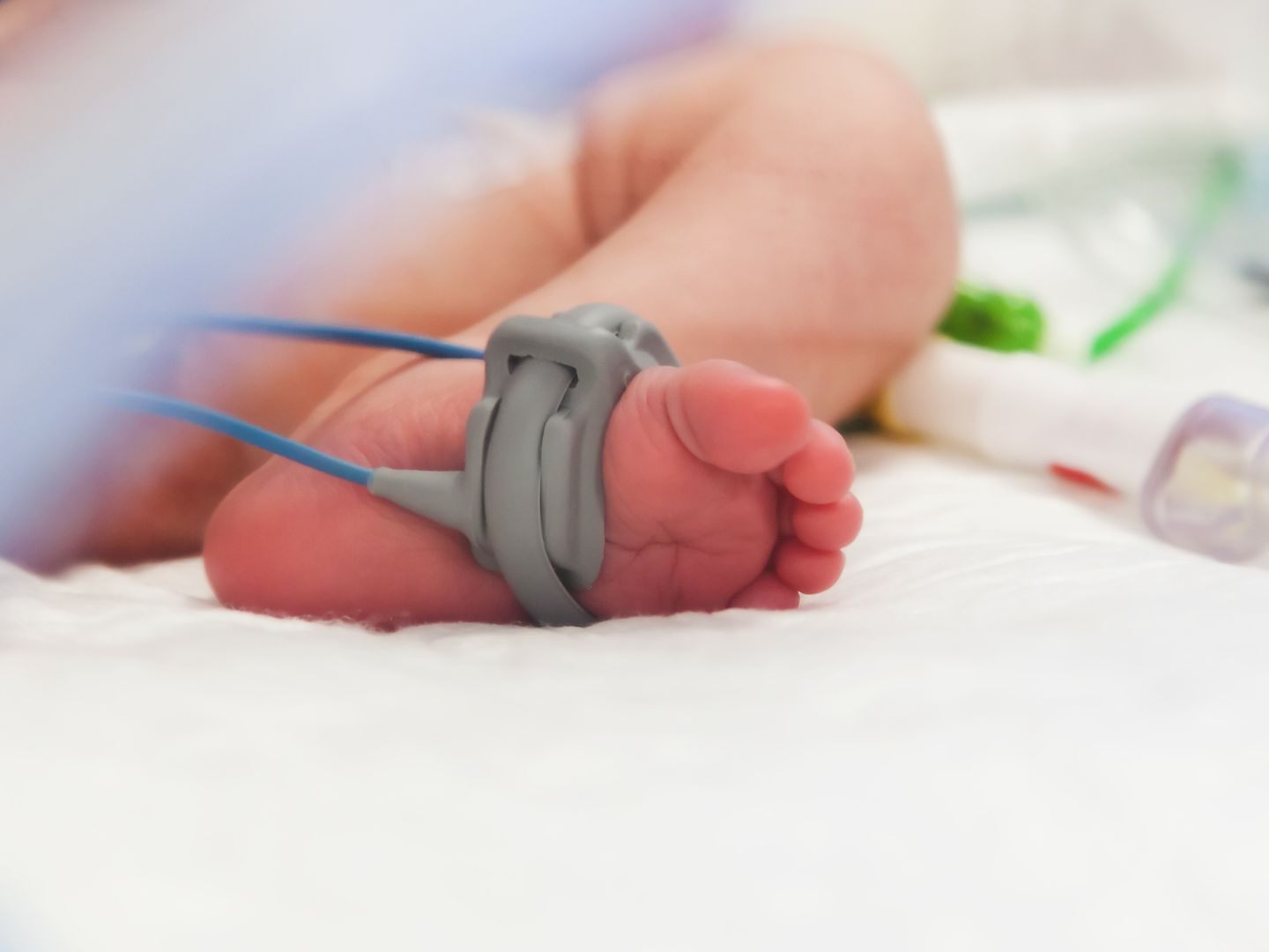 Ein Baby kämpft in Wien ums Überleben.