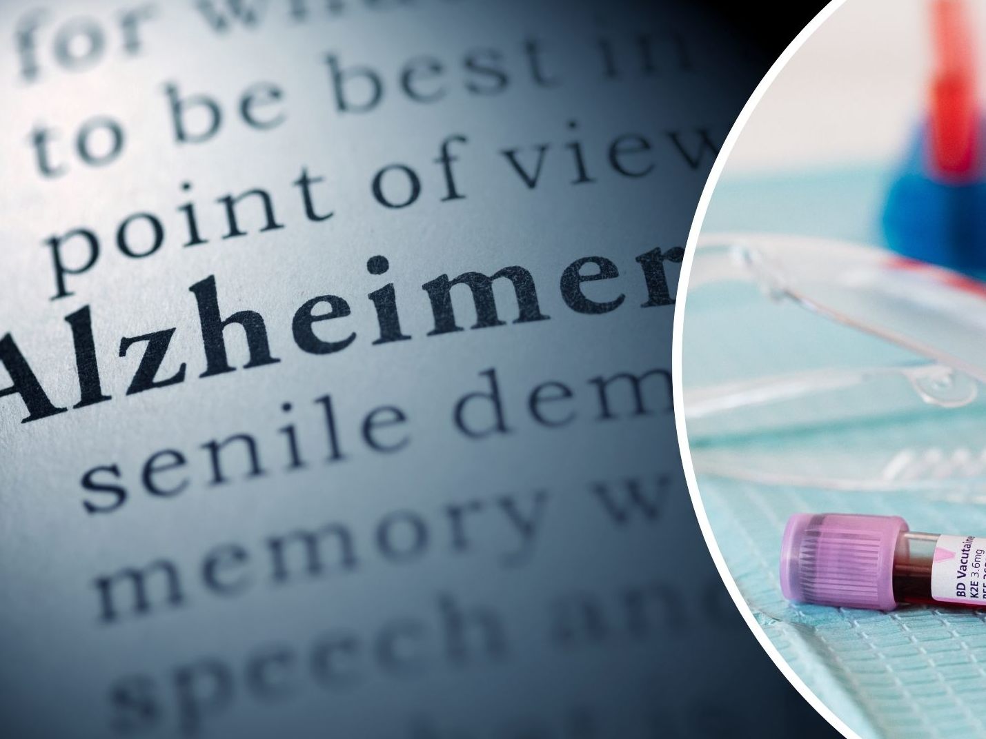 Forschungserfolg: Alzheimer-Mittel hilft bei Blutkrankheit.