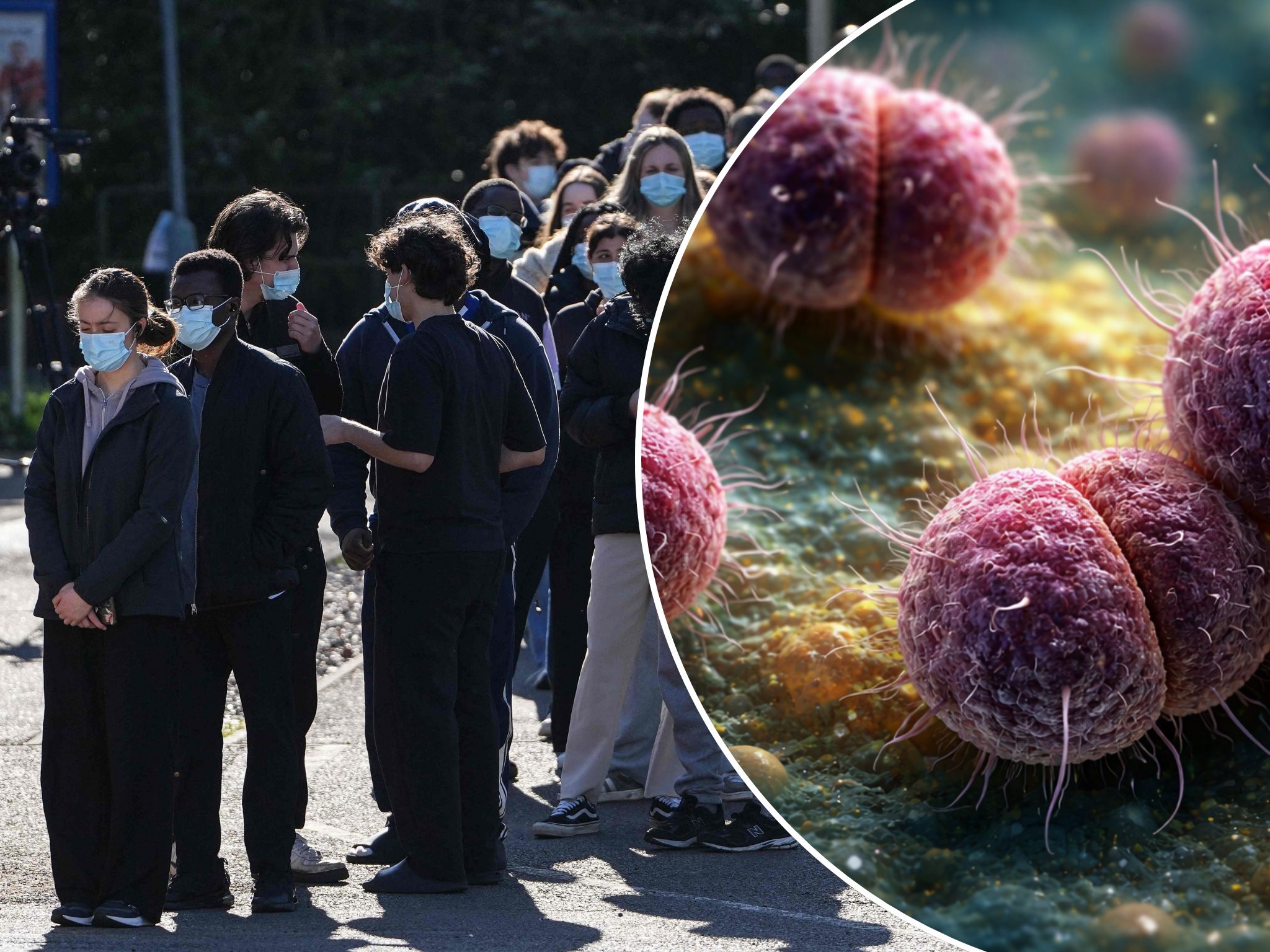 Könnte der Meningitis-Ausbrich in Großbrittannien auch für uns gefährlich werden?